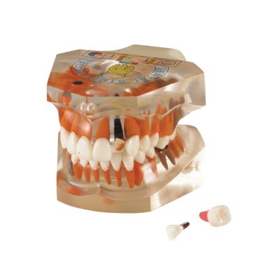 TOOTH MODEL P-TYPE - прозрачная демонстрационная модель челюсти | Hanil (Ю. Корея)