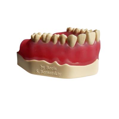 ЧИ-14 – модель челюсти для практики имплантации и пересадки трансплантата | Medskills (Россия)