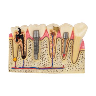 STF MODEL - демонстрационная модель | Hanil (Ю. Корея)