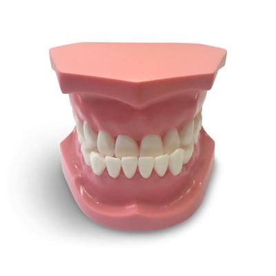 ORB04 – ортодонтическая модель с брекетами и твердой десной | GF Dental (Италия)