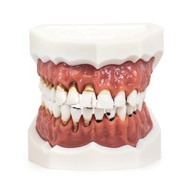 Модель верхней и нижней челюсти с различными патологиями | Dentalstore (Италия)