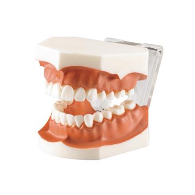 TOOTH MODEL G-TYPE - фантомная челюсть с несъемными зубами | Hanil (Ю. Корея)