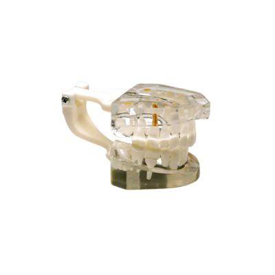 T03– демонстрационная модель верхней и нижней челюсти десятилетнего ребенка | GF Dental (Италия)