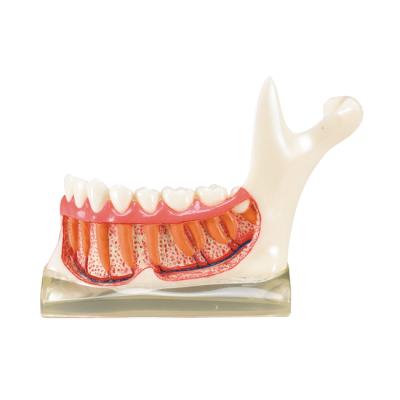 TOOTH MODEL N-TYPE - демонстрационная модель нижней челюсти с сагиттальным разрезом | Hanil (Ю. Корея)
