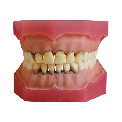 ЧВН-32П - денто-модель верхней и нижней челюстей для практики лечения пародонтоза | Зарница (Россия)