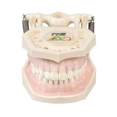 E11 – модель верхней и нижней челюсти с пародонтитом для профессиональной гигиены | GF Dental (Италия)