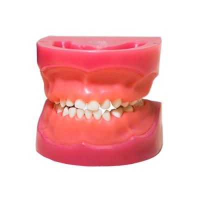 ЧВН-24 N - денто-модель детской верхней и нижней челюсти | Зарница (Россия)