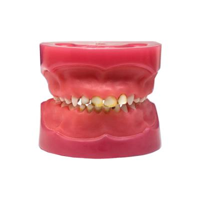 ЧВН-24П - денто-модель детской челюсти с патологиями | Зарница (Россия)