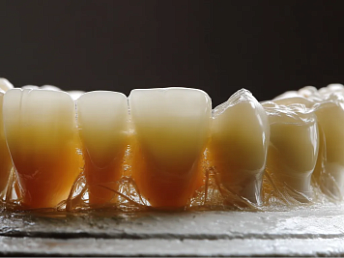 Британские ученые впервые смогли вырастить человеческие зубы в лабораторных условиях Британские ученые впервые смогли вырастить человеческие зубы в лабораторных условиях